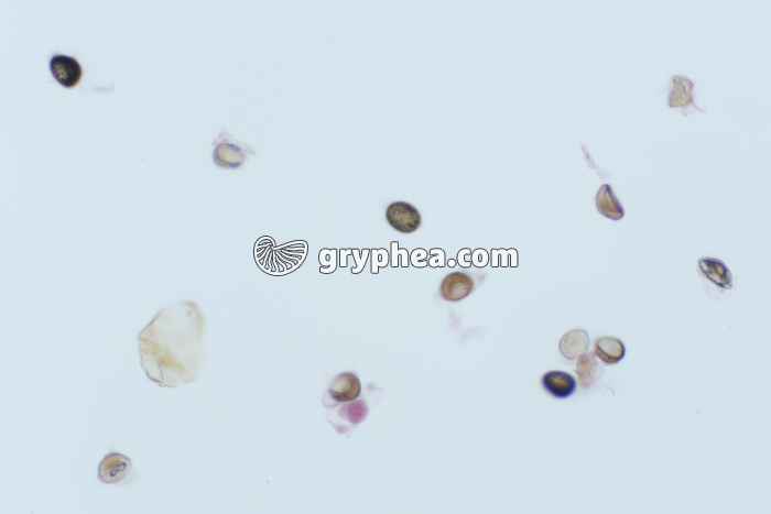 Taenia saginata, oeufs dans déjections x40 - gryphea.org